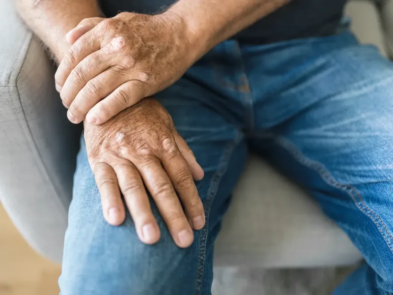 A licensed physical therapist checking an older adult&rsquo;s knee range of motion during an arthritis evaluation