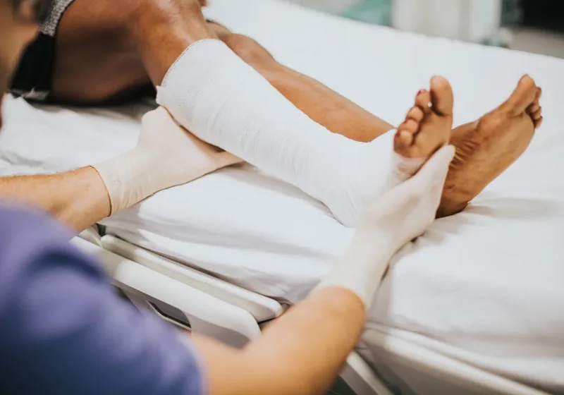 Licensed physical therapist wrapping compression bandaging around a patient arm during complete decongestive therapy